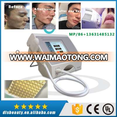 2017 newest Navoxel Tixel with fractional innovation skin rejuvenation/acne scar/wrinkle removal